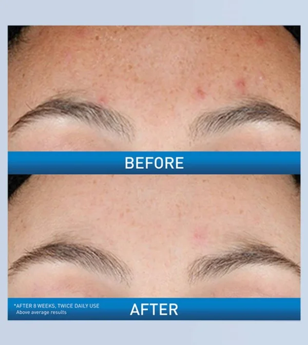 Cerave Resurfacing Retinol Serum  30ML - Image 2
